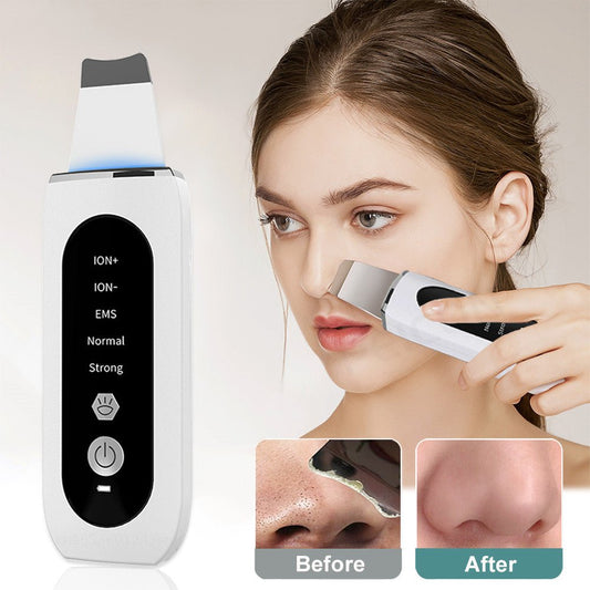 Skin Ultrasonic Blackhead Remover - OMG! Rose